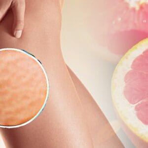 For a beautiful body - Anti-cellulite massage (60 min)