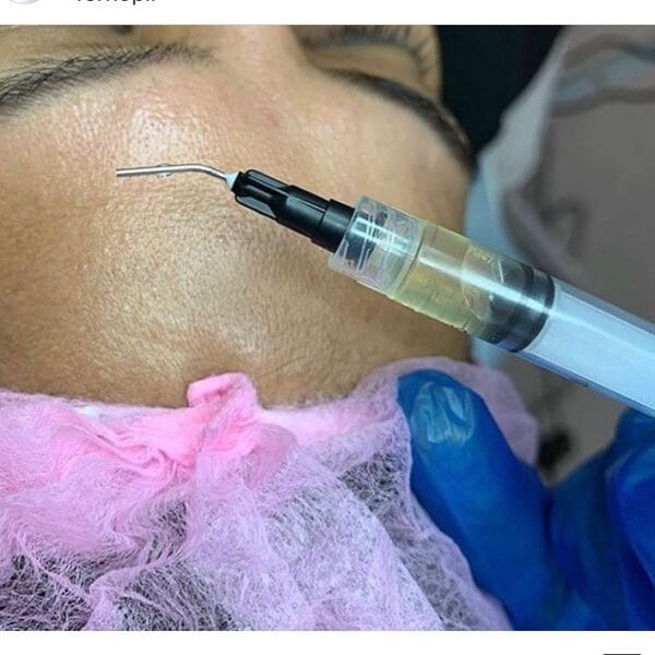 Facial peeling procedure - all season JPX3 Bio - Image 2