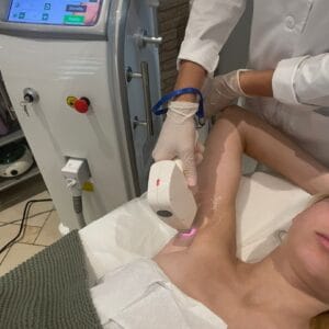 Лазерная эпиляция подмышек