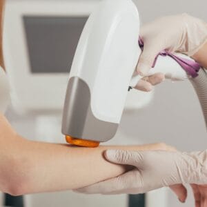 Лазерная эпиляция комплект - руки + подмышки